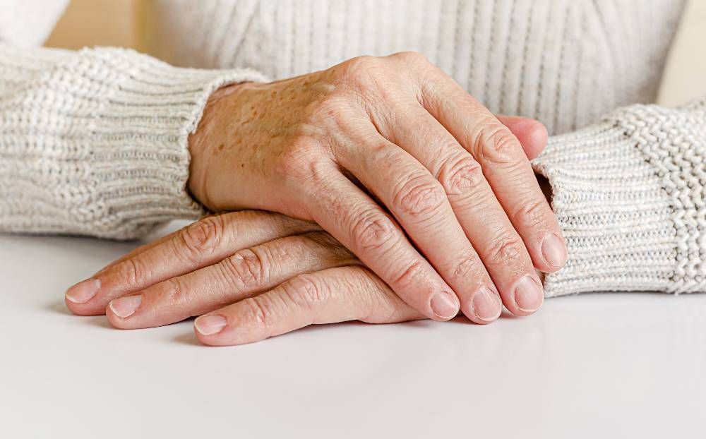 ¿Por qué salen manchas en la piel y cómo prevenirlas?